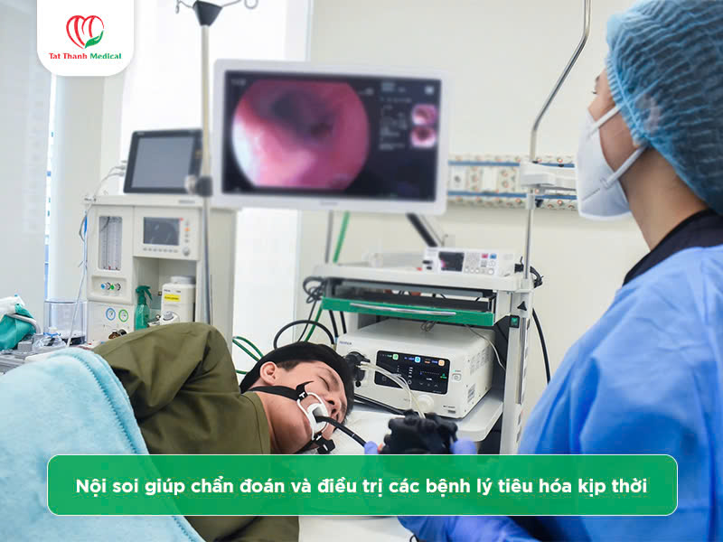Hệ thống nội soi tiêu hóa dạ dày đại tràng: Đâu là lựa chọn hàng đầu?