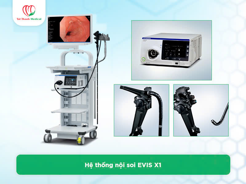 Hệ thống nội soi tiêu hóa dạ dày đại tràng: Đâu là lựa chọn hàng đầu?