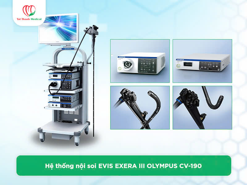 Hệ thống nội soi tiêu hóa dạ dày đại tràng: Đâu là lựa chọn hàng đầu?