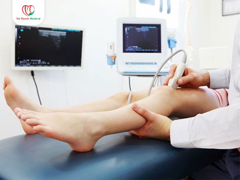 RFA kết hợp foam sclerotherapy: Giải pháp toàn diện trong điều trị suy giãn tĩnh mạch chi dưới