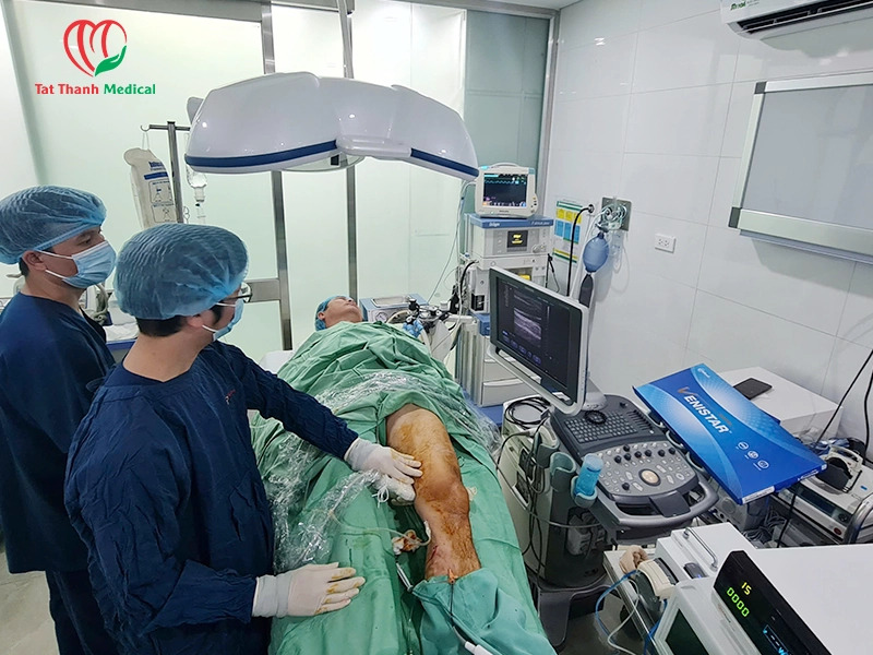 RFA kết hợp foam sclerotherapy: Giải pháp toàn diện trong điều trị suy giãn tĩnh mạch chi dưới